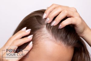 Combat Hair Loss During Autumn: Why Now?